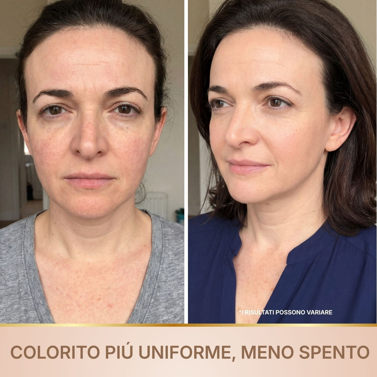 Doneva – Siero Coreano Effetto Lifting dalla Prima Applicazione