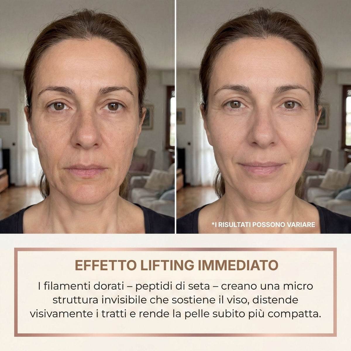 Doneva – Siero Coreano Effetto Lifting dalla Prima Applicazione