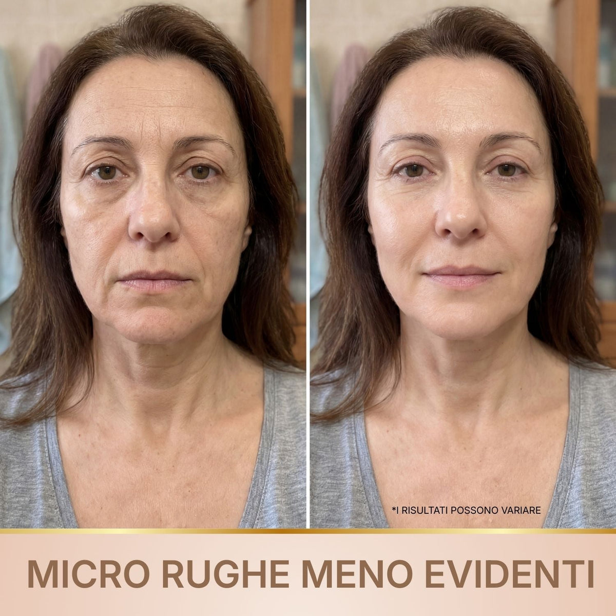 Doneva – Siero Coreano Effetto Lifting dalla Prima Applicazione