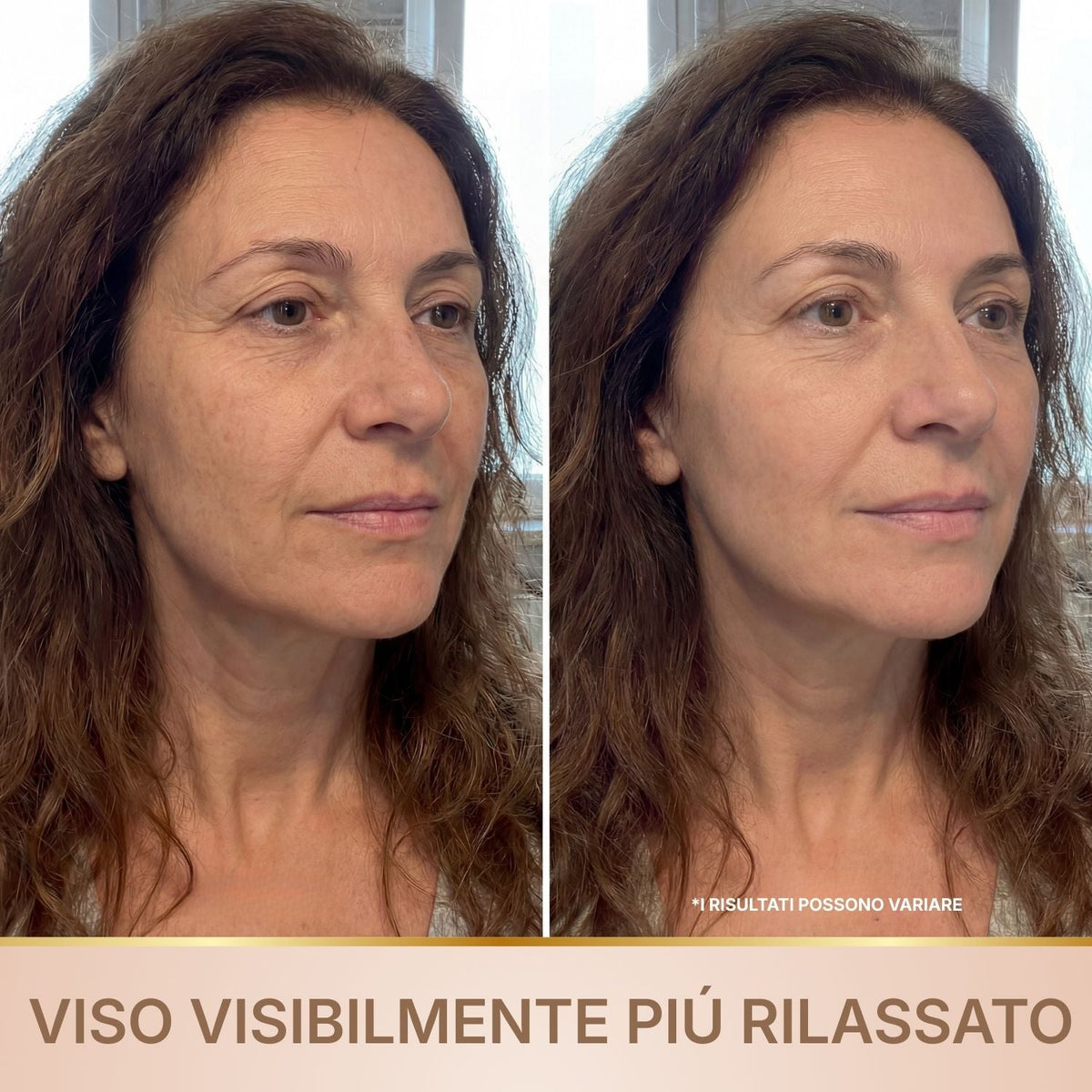 Doneva – Siero Coreano Effetto Lifting dalla Prima Applicazione
